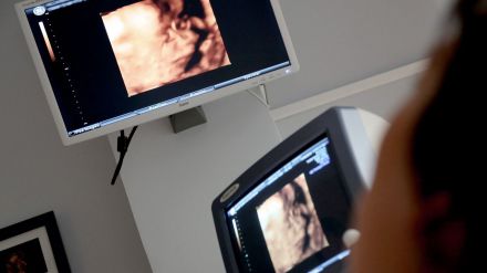 La ecografía pediátrica mejora la detección temprana de la enfermedad de Crohn, según un estudio