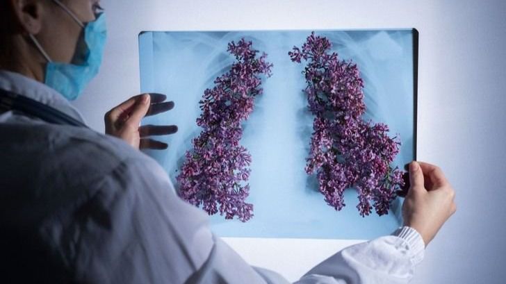 Empresa biotecnológica recibe 9 millones para combatir la fibrosis pulmonar