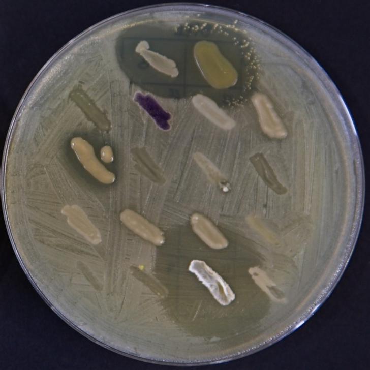 El IBFG relanza el proyecto 'MicroMundo' para descubrir nuevos antibióticos